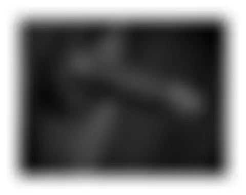 Locked photo 10